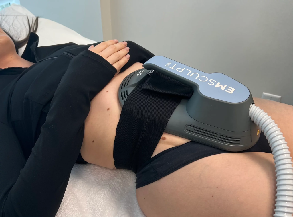 Emsculpt Neo session in progress at iCRYO Grosse Pointe